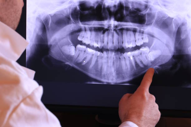 Best Emergency Treatment for Toothache in Whippany, NJ