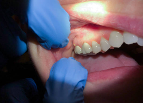 Best Emergency Dental Surgery in Whippany, NJ